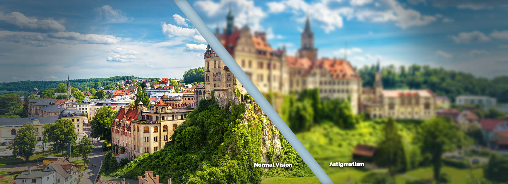 Astigmatism Treatment in Becker