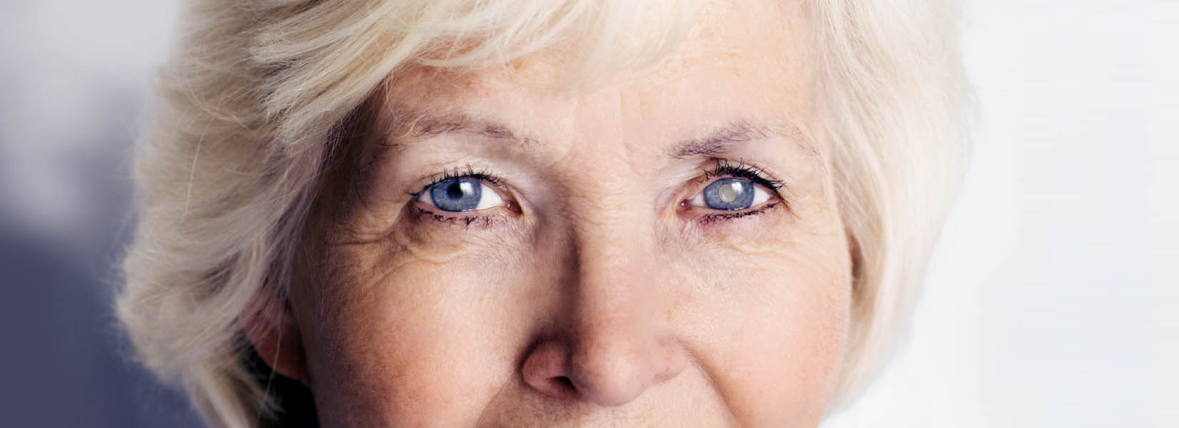 Cataract Surgery in Becker